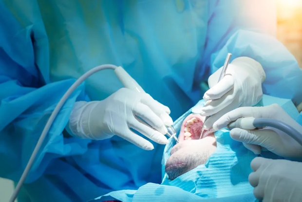 Extractions